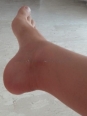 Photo #1