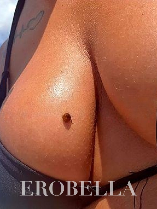 Photo #1