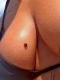 Photo #1