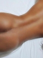 Photo #1