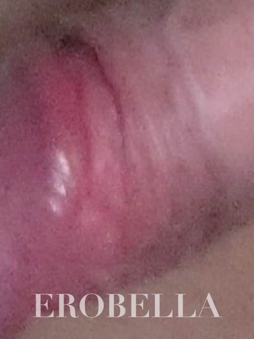 Photo #1