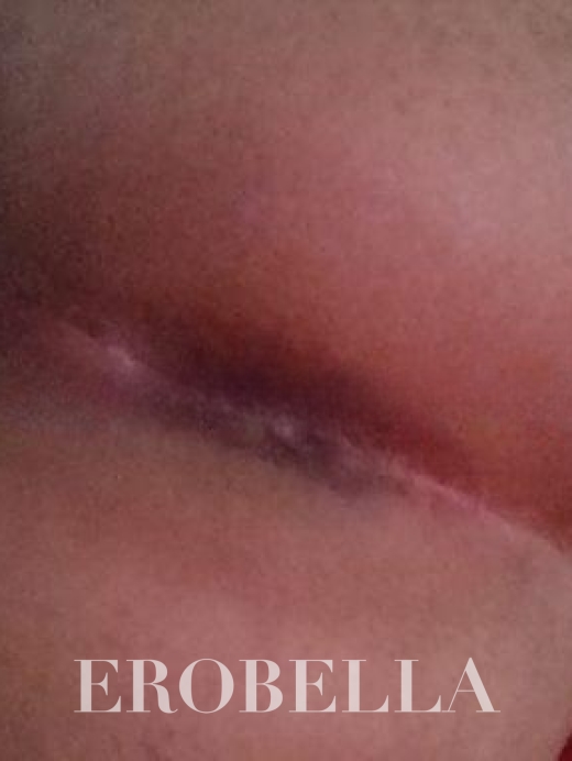 Photo #1