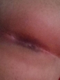 Photo #1