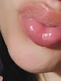 Photo #1