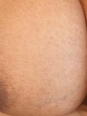 Photo #1
