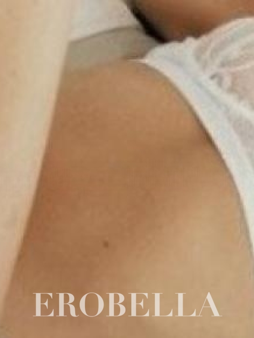 Photo #1