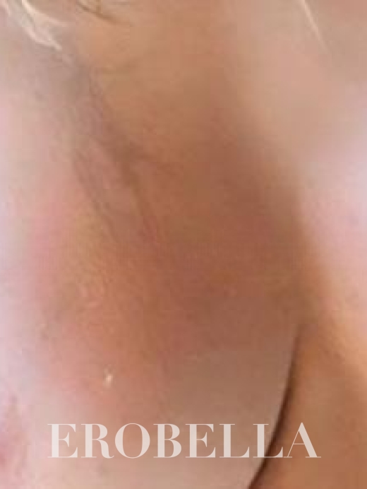 Photo #1