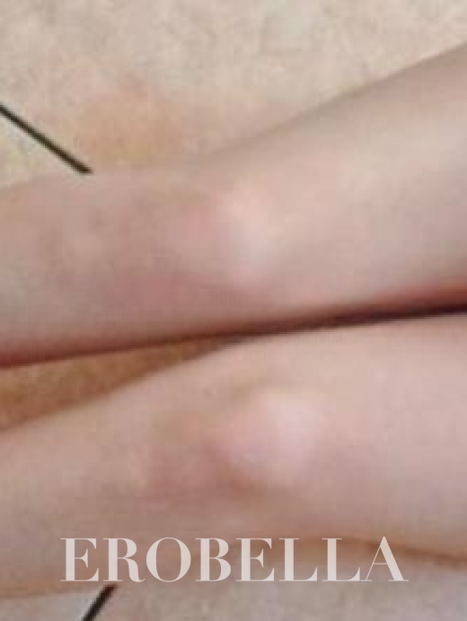 Photo #1