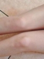 Photo #1