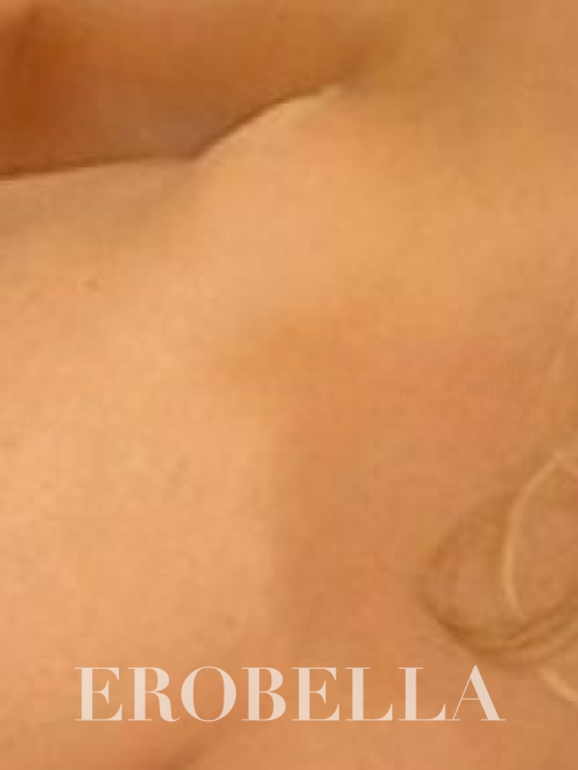 Photo #1