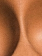 Photo #1