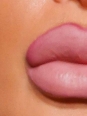 Photo #1