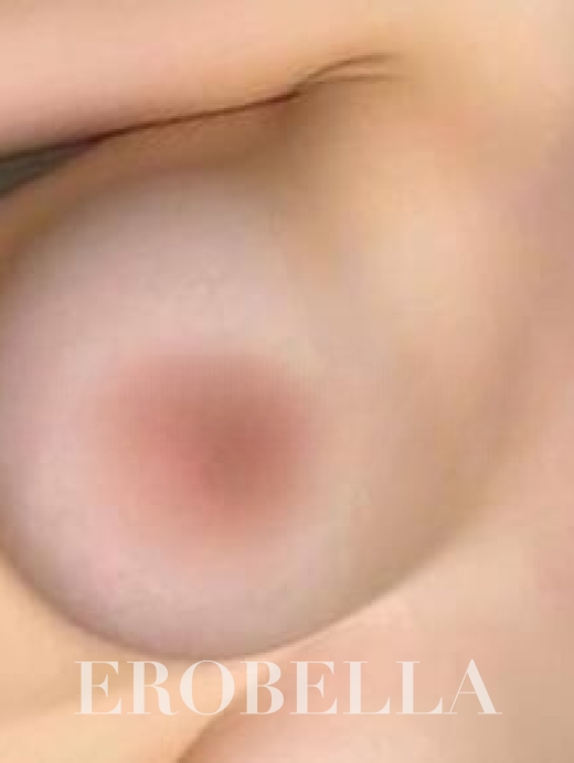 Photo #1
