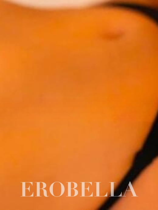 Photo #1