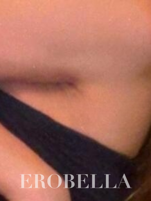 Photo #1