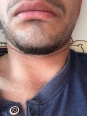 Photo #1