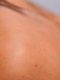 Photo #1