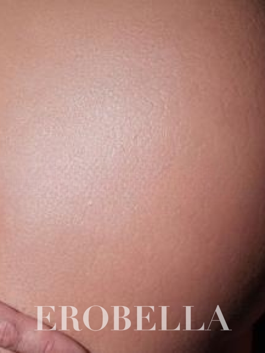 Photo #1