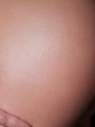 Photo #1
