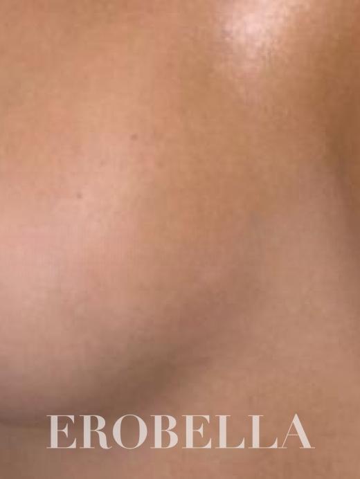 Photo #1
