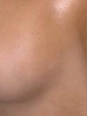 Photo #1